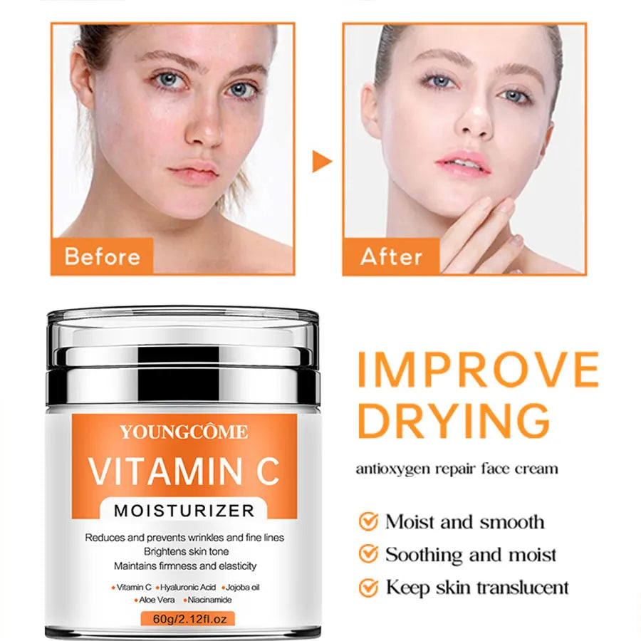 YOUNGCOME VitaminC Face Cream SkinCare Pigment Spots Freckles Remover Whitening Moisturizing Anit-Aging Beauty Health Cosmetics (Copie)